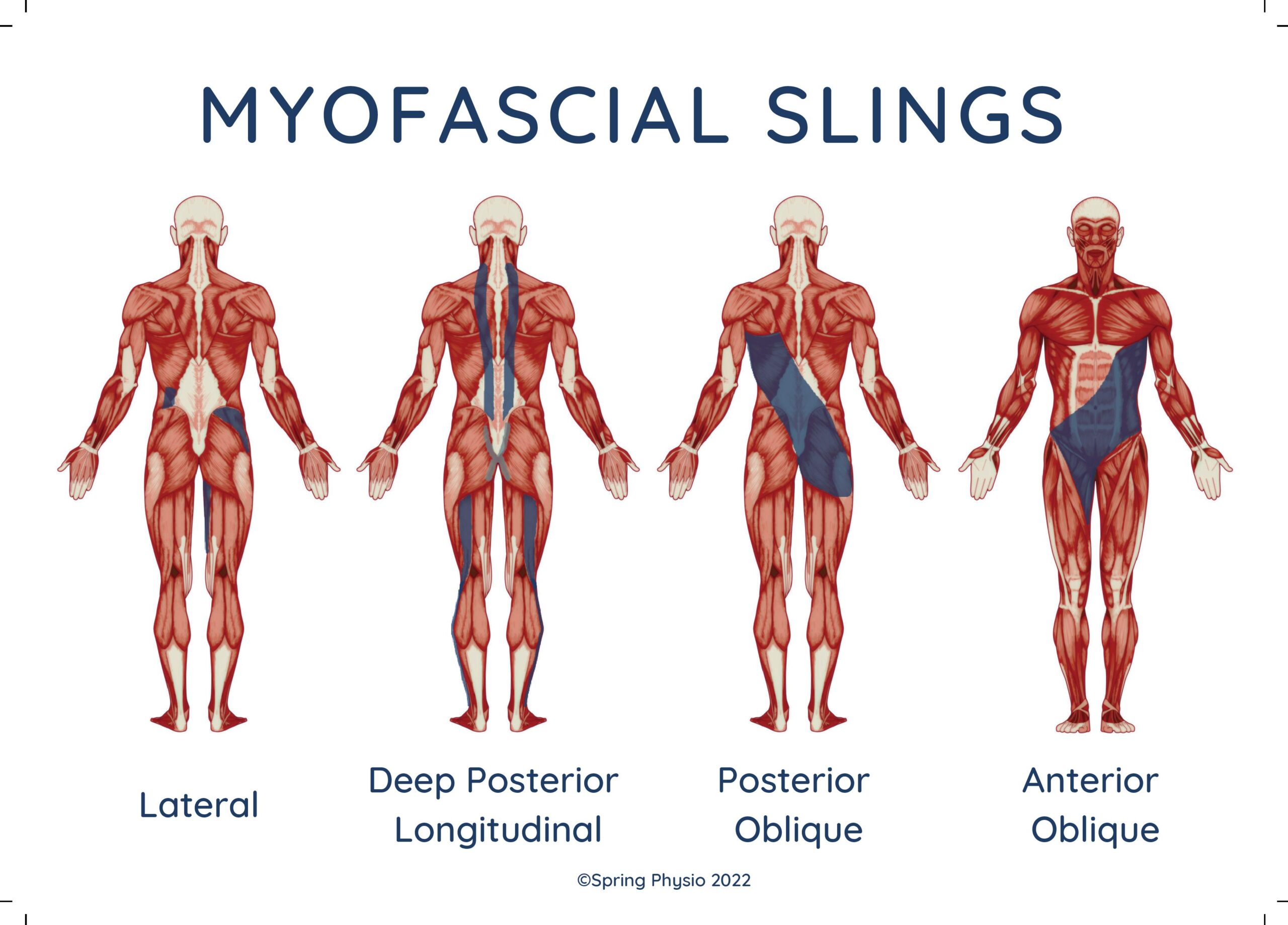 Illustrates the muscle groups considered part of the myofascial sling concept of muscles.